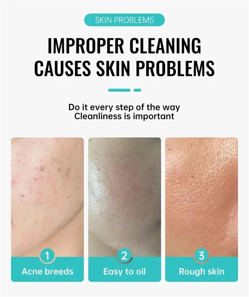 Salicylic Acid Acne Treatment Face Cream Repair Pimple Spots Deep Cleaning Pore Anti-acne Scar Oil Control Moisturizer Skin Care