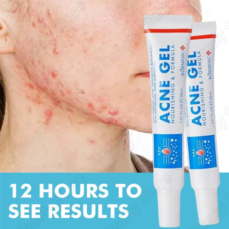 Salicylic Acid Acne Treatment Face Cream Repair Pimple Spots Deep Cleaning Pore Anti-acne Scar Oil Control Moisturizer Skin Care