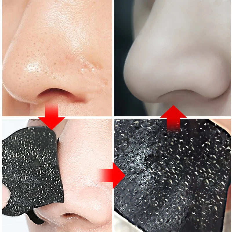 Nose Strips For Blackheads Acne Removal Instant Pore Unclogging Strips Deep Cleansing Nose Clean Patch Strips